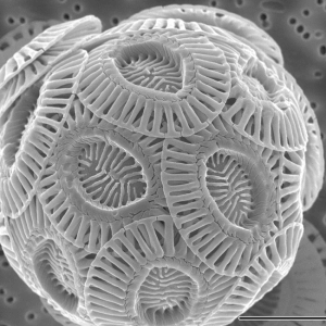 הווירוס הקטלני לאצות אינו מזיק לבני אדם כלל. צילום: Alison R. Taylor (University of North Carolina Wilmington Microscopy Facility)