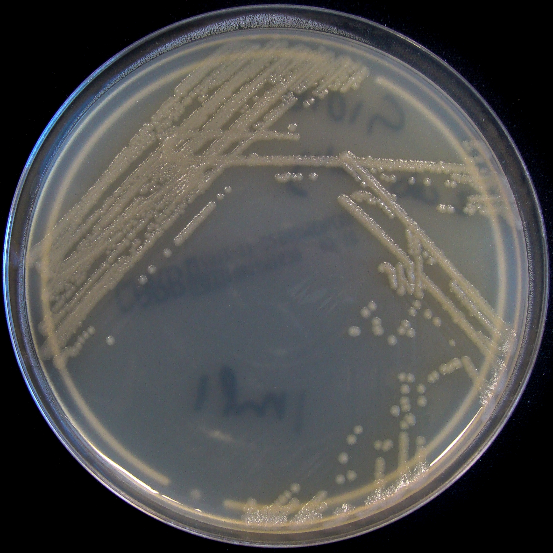 Бактерия синегнойная палочка. Синегнойная палочка псевдомоноз. Синегнойная палочка под микроскопом. Pseudomonas aeruginosa микробиология. Pseudomonas aeruginosa колонии.